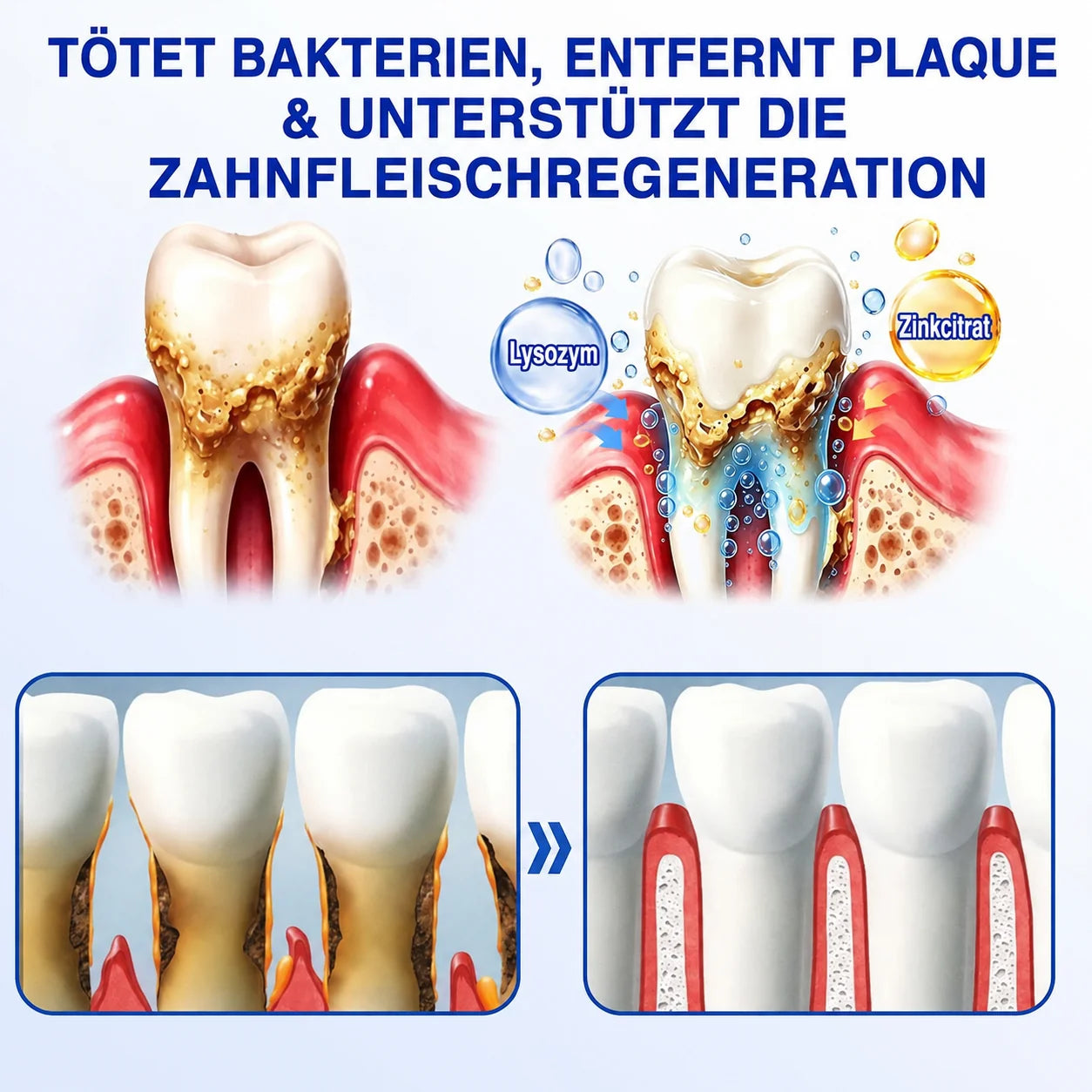 PERIVA® Zahnfleisch Intensivgel – Gezielte Pflege gegen Mundgeruch & Empfindlichkeit