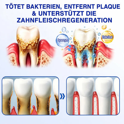 PERIVA® Zahnfleisch Intensivgel – Gezielte Pflege gegen Mundgeruch & Empfindlichkeit