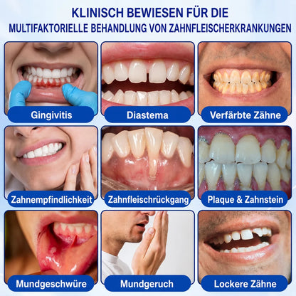 PERIVA® Zahnfleisch Intensivgel – Gezielte Pflege gegen Mundgeruch & Empfindlichkeit