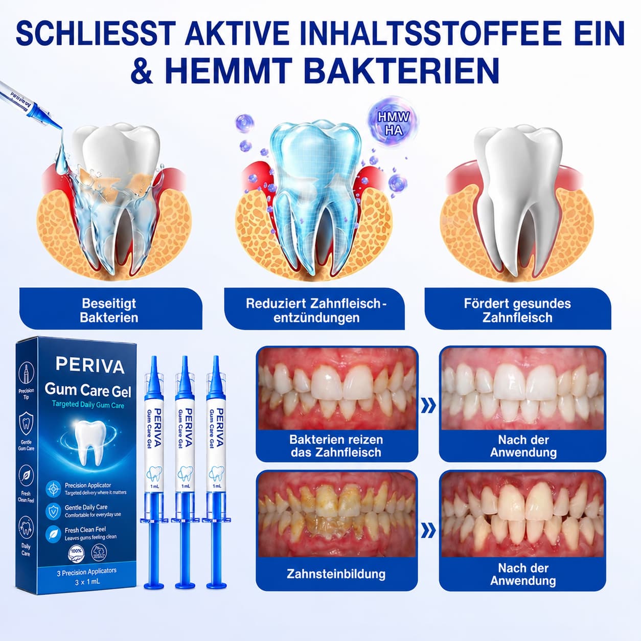 PERIVA® Zahnfleisch Intensivgel – Gezielte Pflege gegen Mundgeruch & Empfindlichkeit