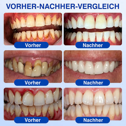 PERIVA® Zahnfleisch Intensivgel – Gezielte Pflege gegen Mundgeruch & Empfindlichkeit